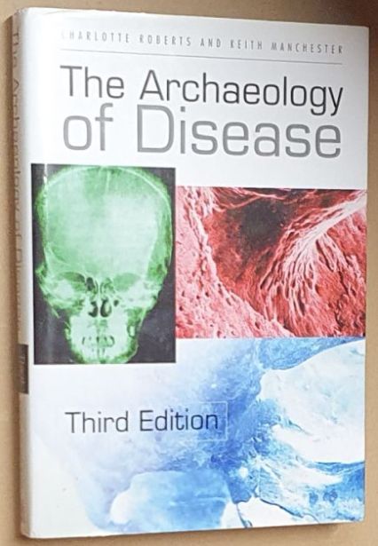 The Archaeology of Disease